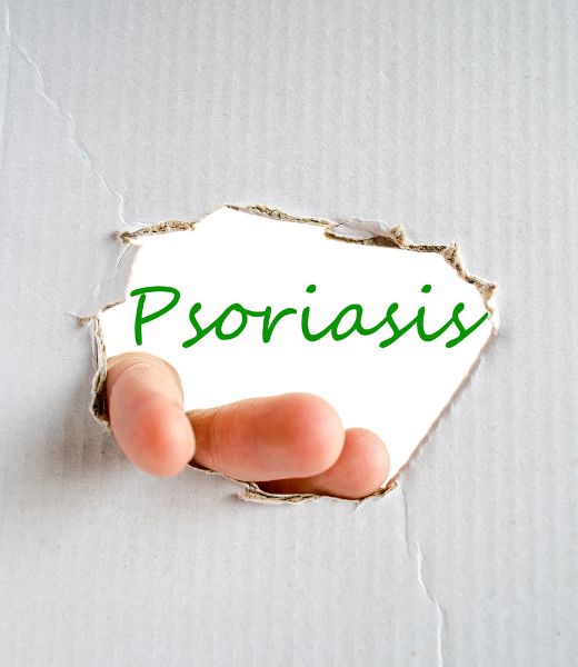 Comprar tratamientos para la Psoriasis.